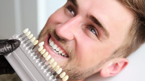 Young man choosing color of teeth at dentist
